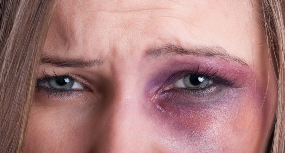 Huiselijk geweld: bij twijfel vrijspraak